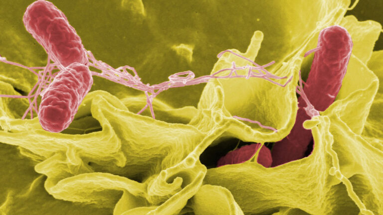 kumpirden-olum-sonrasi-salmonella-bakterisi-uyarisi-zd9e.jpg